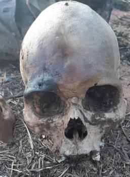 Encontró restos óseos cuando buscaba “plata yvyguy” en Ypacaraí