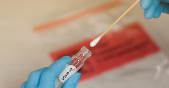 Varios laboratorios redujeron los precios del test PCR, según Sedeco